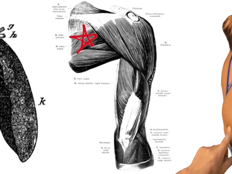 Fascial Counterstrain Part 1