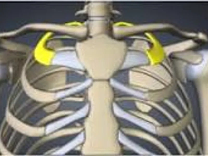 Unlocking the First Rib: Small Structure, “Big Impact” – A Fascial Counterstrain Approach